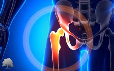 Anterior Hip Replacement with Bikini Incision
