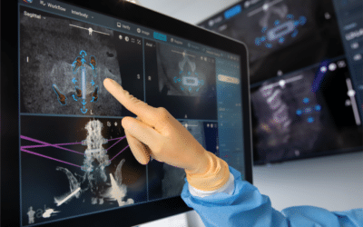 Intraoperative Navigation and Robotic Systems